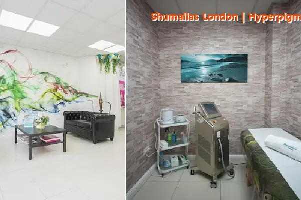 shumailas london | hyperpigmentation melasma hair loss skin tag removal treatment