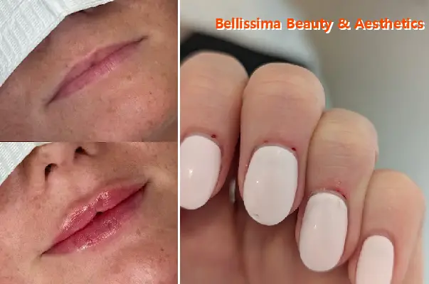 bellissima beauty & aesthetics ltd   skin & laser clinic surrey