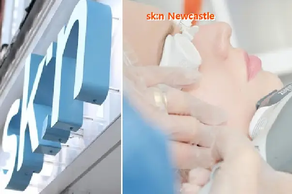 sk:n newcastle