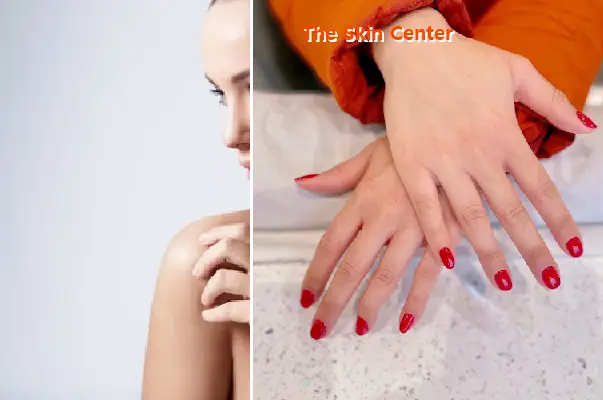 the skin center