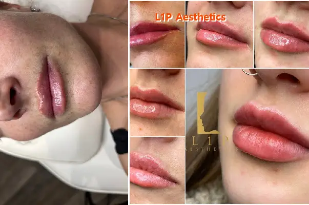 l1p aesthetics